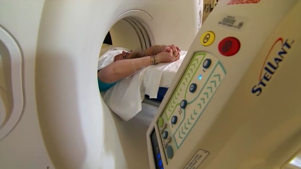 ¿Detectar el cáncer de páncreas hasta tres años antes de un diagnóstico médico? Modelo de IA abre nueva esperanza