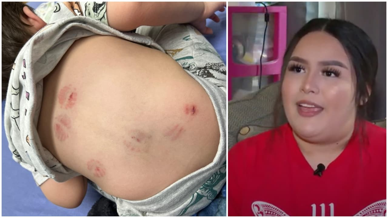 'Oh, Dios, ¿son mordidas?’: Padres hispanos demandan por $1 millón a guardería en Texas tras ataque a su bebé