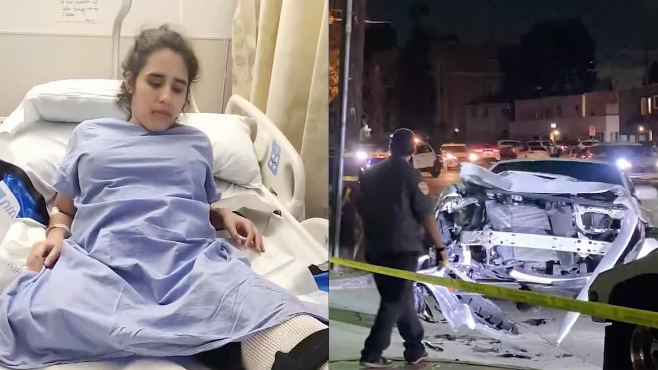 Hispana pierde pierna en atropello y podría sufrir otra amputación por falta de seguro