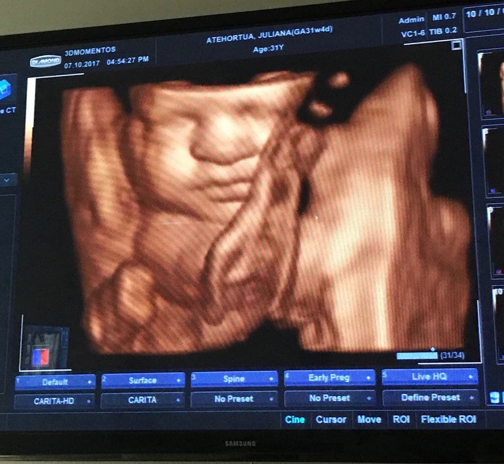 Algunos días antes de su llegada, nuestro chef nos mostró esta tierna imagen donde se podía ver la carita de su bebé.