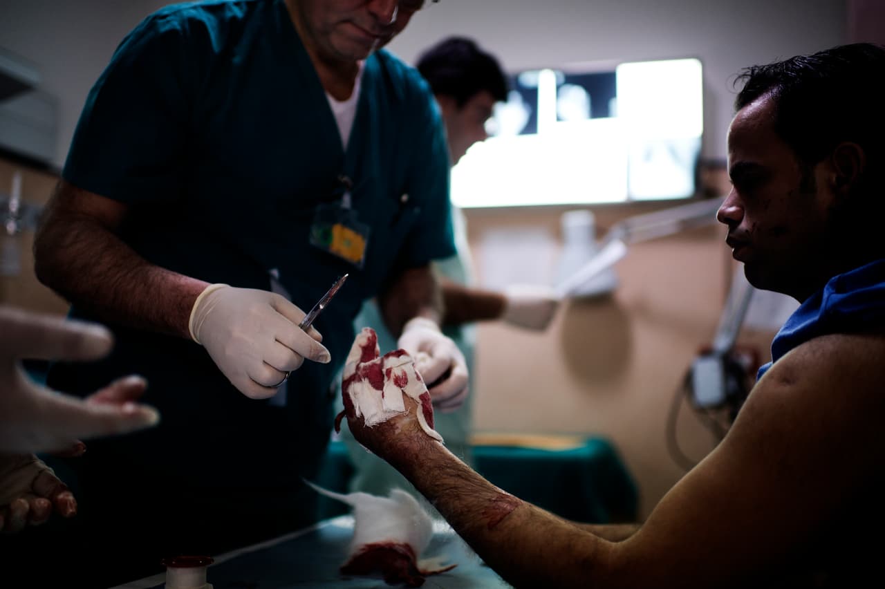 Advierten de peligrosos “fireworks” que pueden dejarlo mocho