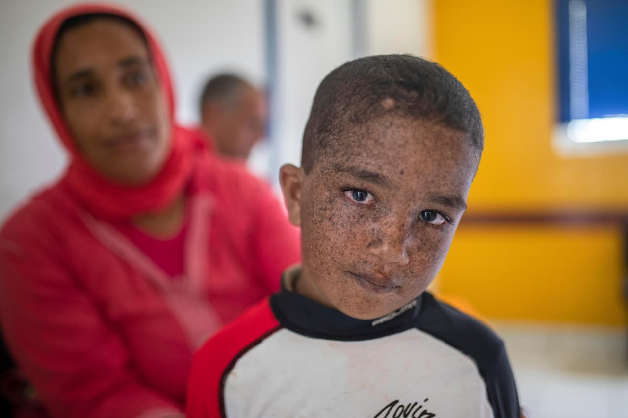 Mustapha, en primer plano, ya ha tenido 11 operaciones para eliminar crecimientos cancerosos en su piel.