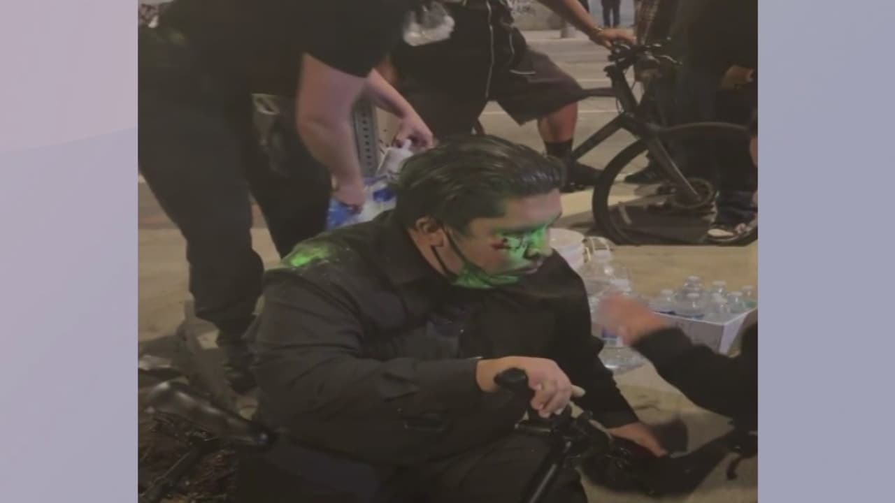 Joven de 22 años en riesgo de perder la vista tras ser impactado por policía en protesta