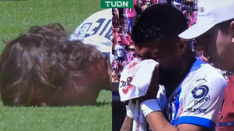 Rayados es un hospital y suma ante Pumas tres lesionados más a su lista