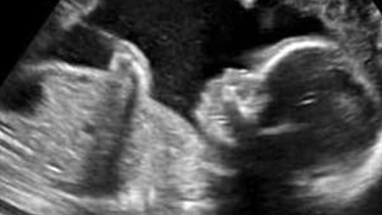 Fue en ese momento que Reyes se dio cuenta que tenía que luchar contra el
<b><a href="https://www.univision.com/temas/coronavirus">coronavirus</a></b> y tuvo un motivo mucho más importante que su vida; su bebé y el deseo de que naciera sana.