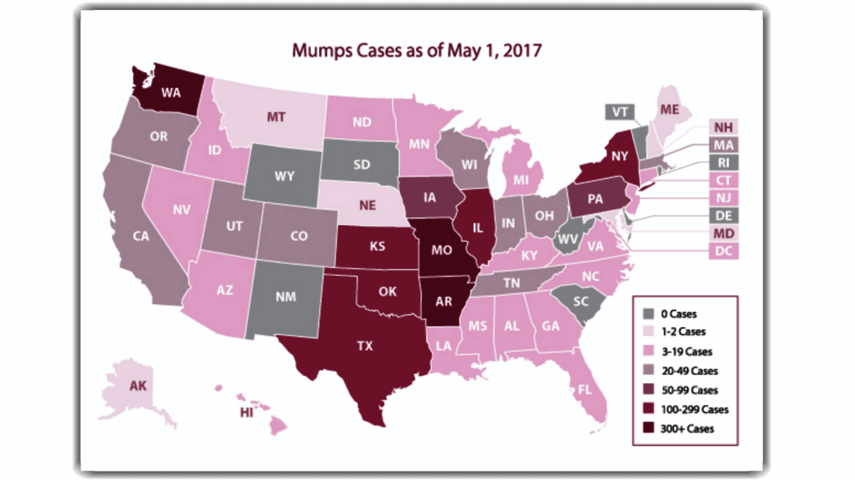 El mapa de las paperas en EEUU.