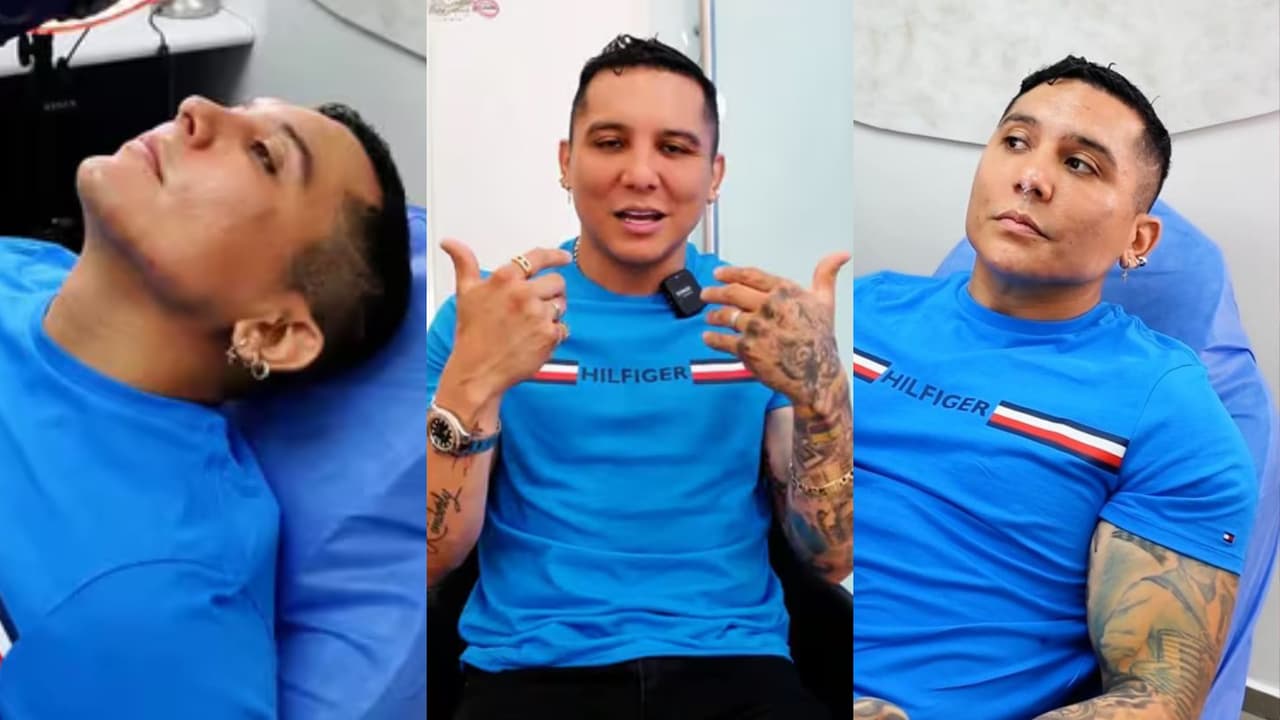 Así presumió Edwin Luna los resultados de su último arreglito estético.