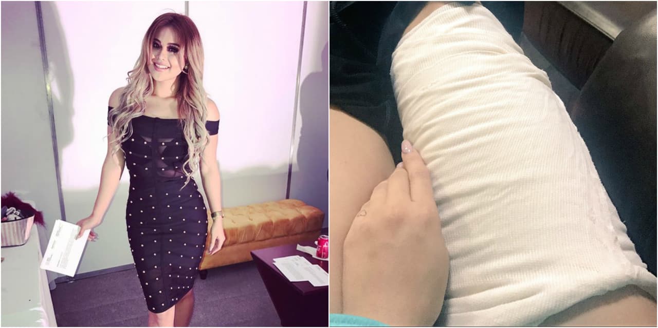 Gomita sufre accidente en terremoto de México