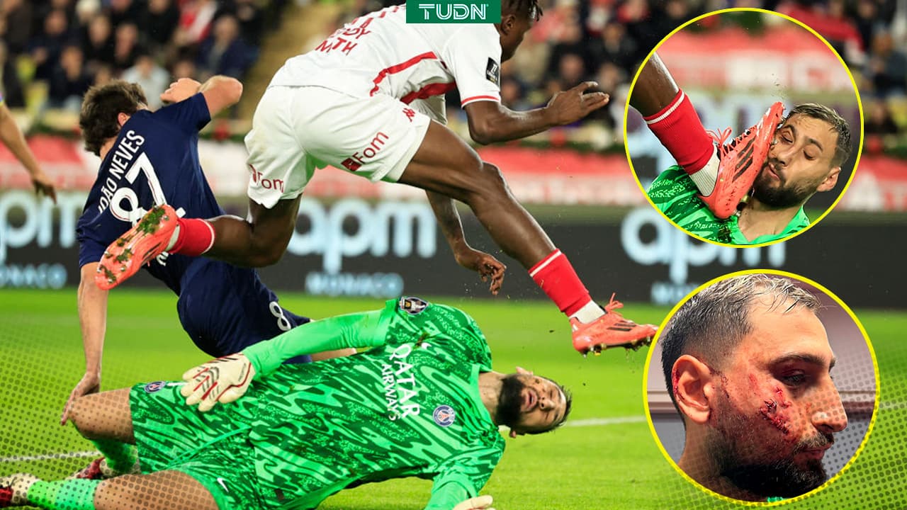 ¡Entrada de cárcel! Portero Donnarumma sale con grave lesión 