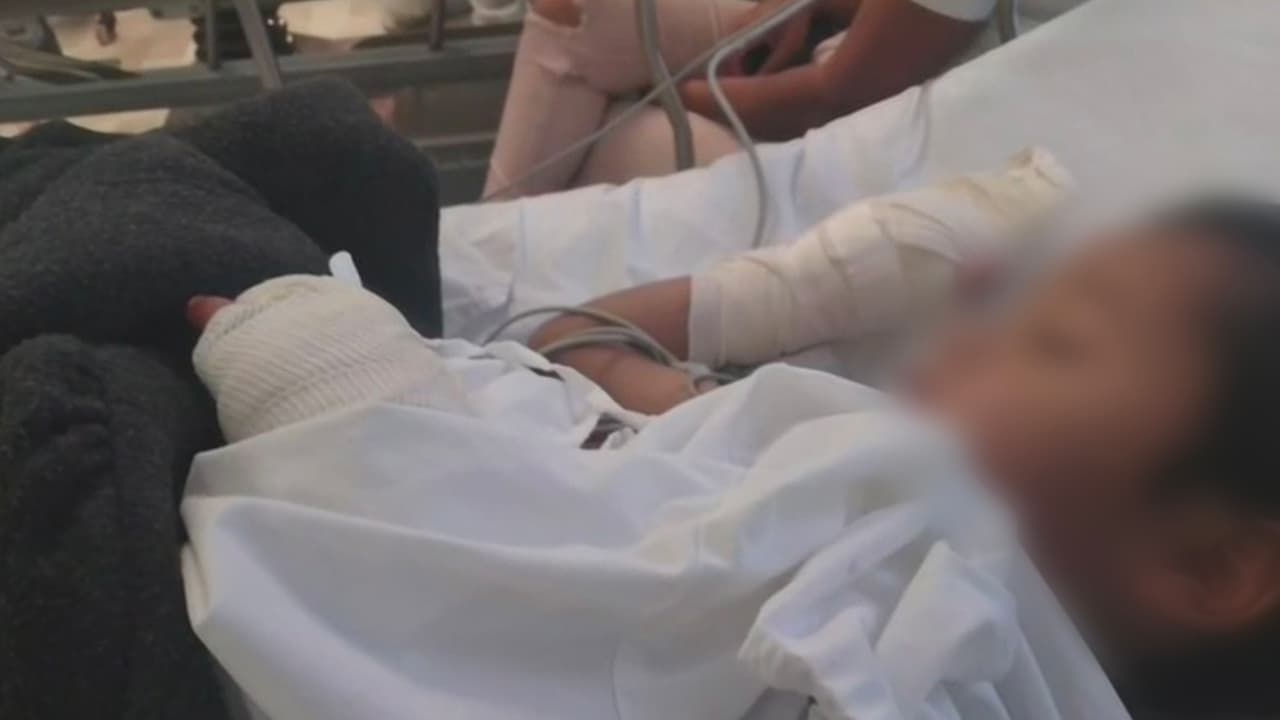 <b>Un niño podría perder sus manos: una bala perdida impactó el celular con el que jugaba</b>
<br>
<br>El pequeño Leonel, de 5 años, se encuentra con sus manos lesionadas debido a que una bala impactó el celular con el que estaba jugando y lo hizo estallar.
