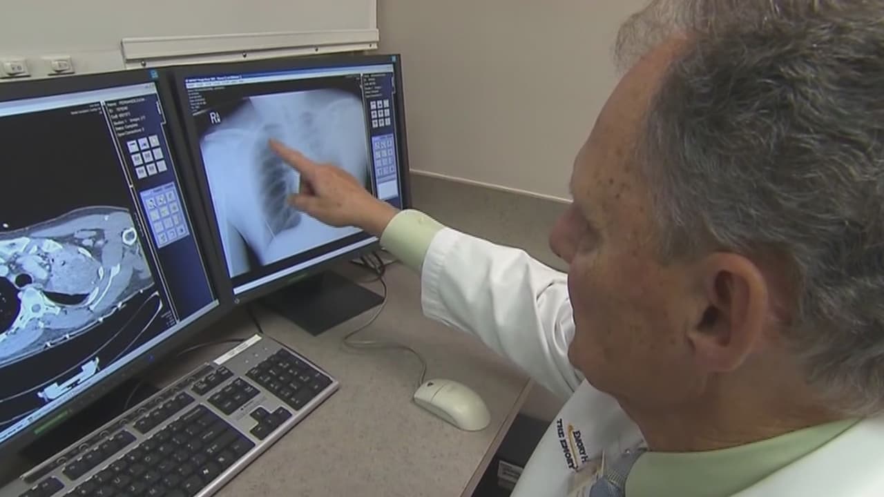 El papa León XIV y su cáncer de pulmón: analizamos su situación de salud