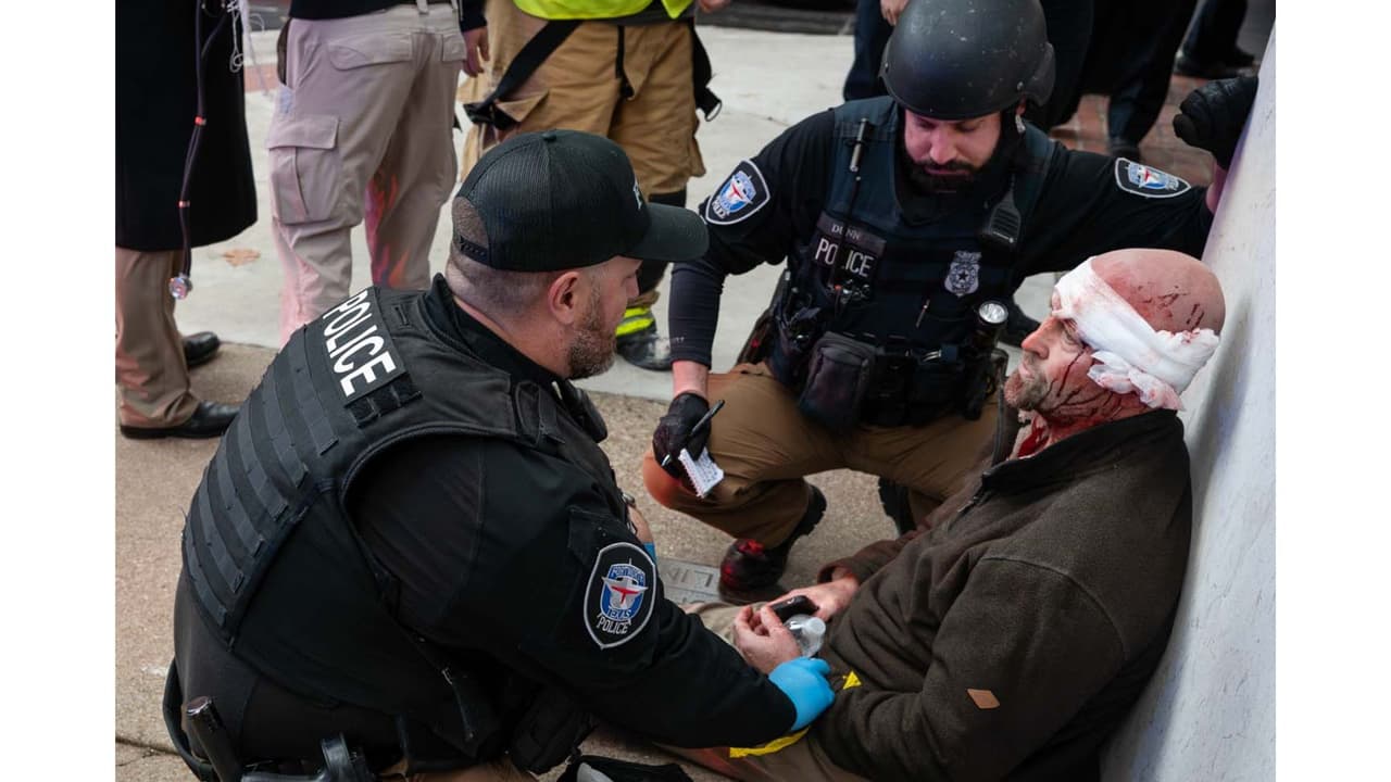 Entre los 21 heridos, hubo uno que se fue por su propia cuenta a un hospital.