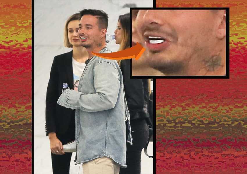 J Balvin sorprendió en en una tienda de Beverly Hills, al mostrar una dentadura muy brillante.