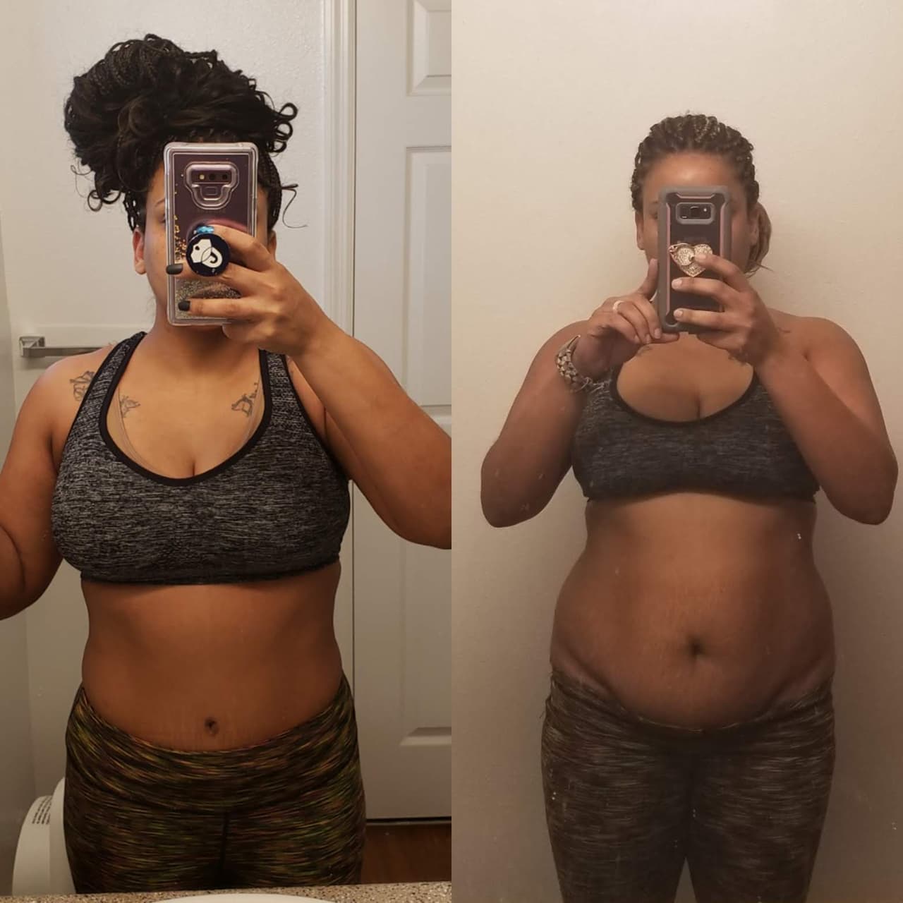 Renata Williams tenía claro cuando acudió al quirófano que su transformación no sería completa. “Yo no esperaba verme como Meghan Markle o ser ella”, dice.