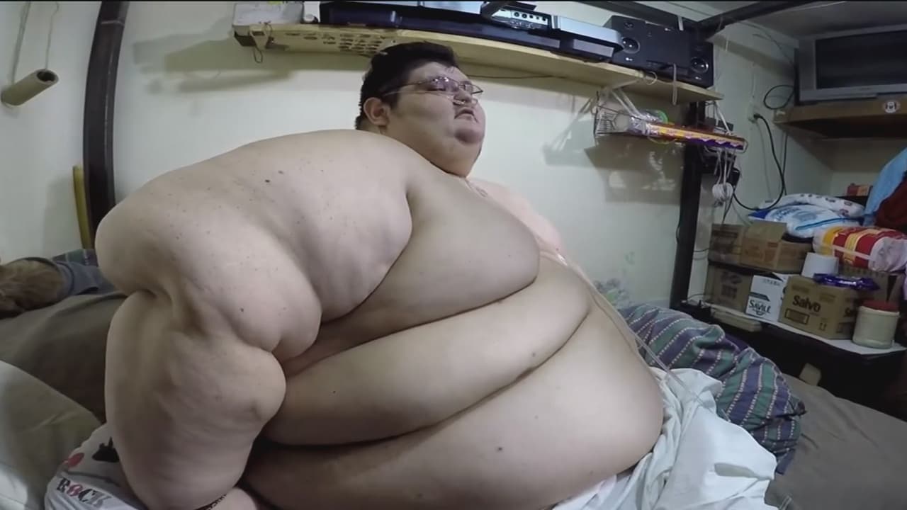 El hombre más obeso del mundo (que llegó a pesar más de 1,000 libras) está listo para ser operado en México