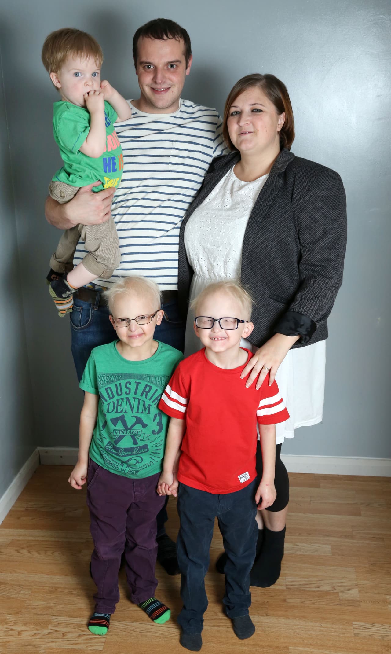 Richard y Lennon McDonald son dos pequeños hermanos que nacieron con una extraña enfermedad.