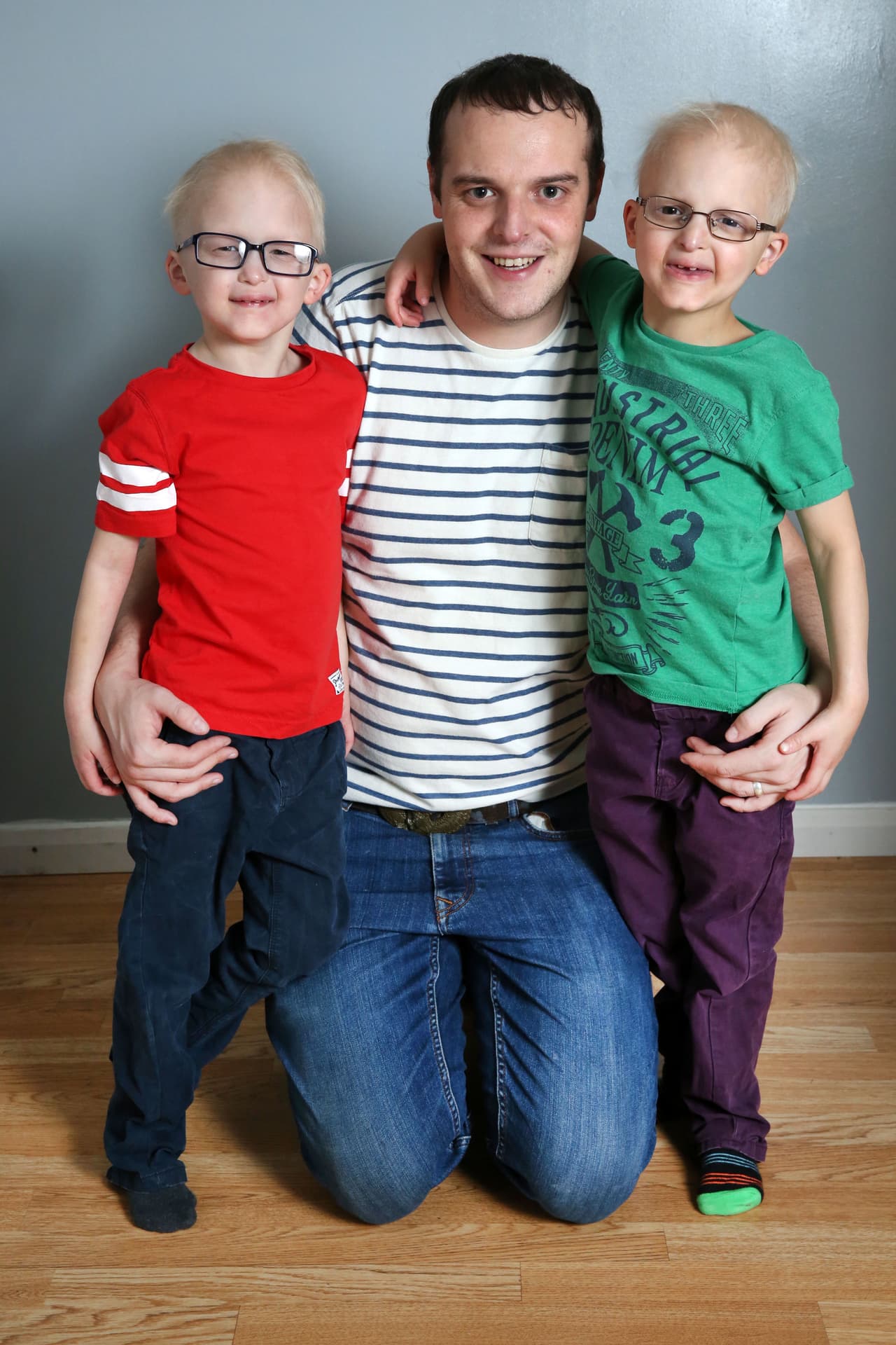 La condición hace que los pequeños luzcan como pequeños y delicados adultos mayores, y en realidad su salud es equiparable.