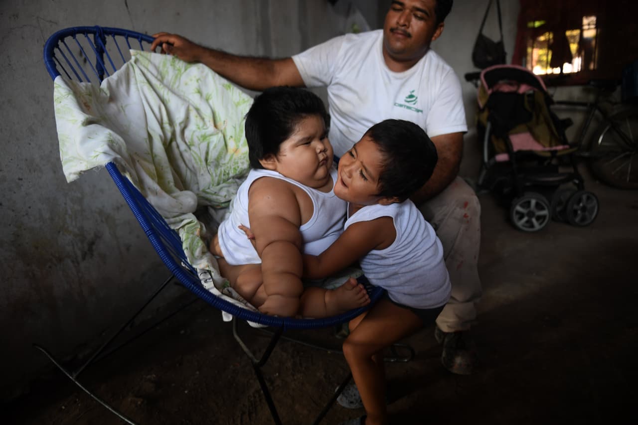 La agencia relata que el pequeño se porta como cualquier bebé: suelta carcajadas cuando le hacen cosquillas, mira con curiosidad a los periodistas, y aparentemente pasa muchas horas al día sin pedir comida. Pero la madre se lamenta porque dice que por ejemplo, Luisito “no puede gatear, ni caminar”. Dice que no pueden colocarlo en una andadera “como a otro niño de 10 meses". Más allá de eso, cuenta Pantoja, Luisito "ya se sienta, sostiene su cabecita, y trata de agarrar él solo el biberón".