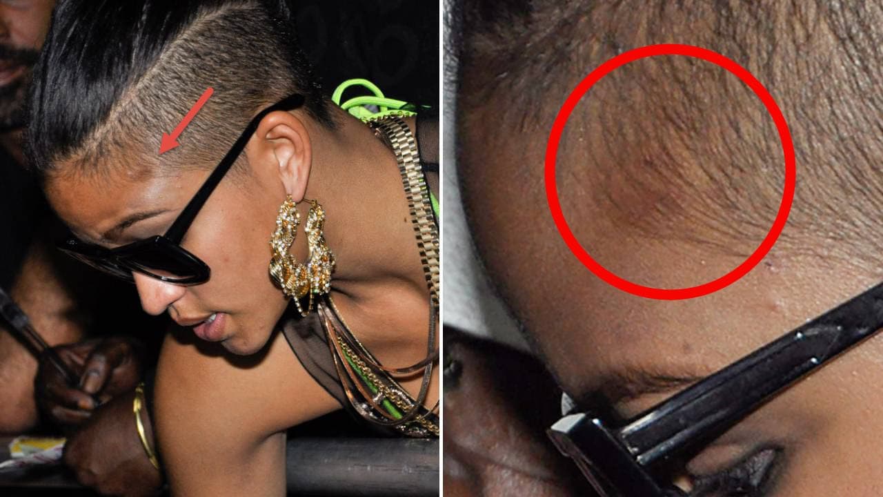 Cassie Ventura aparece en fiesta de 'Diddy' de 2013 con aparente golpe en la cabeza.