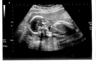 La doctora que la atendió condicionó su ayuda a que Hilda aceptara haberse practicado un aborto.