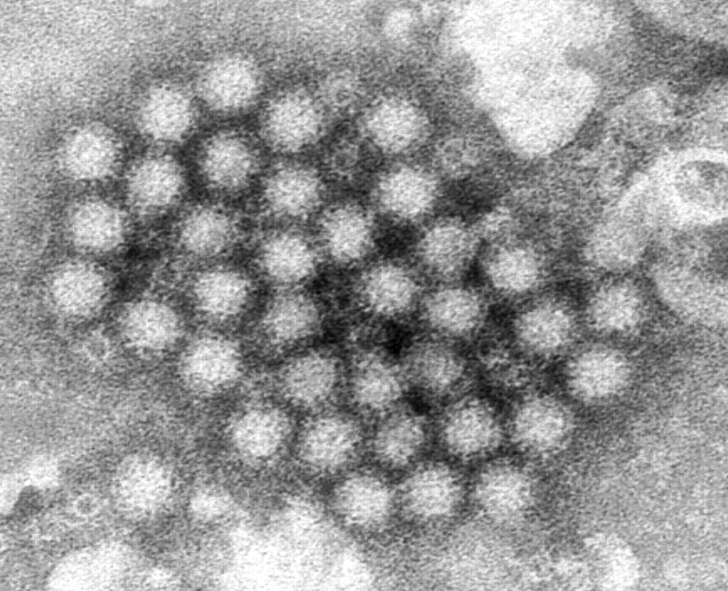 Qué es el norovirus y cómo prevenir la infección estomacal cuyo casos aumentan desde diciembre en EEUU