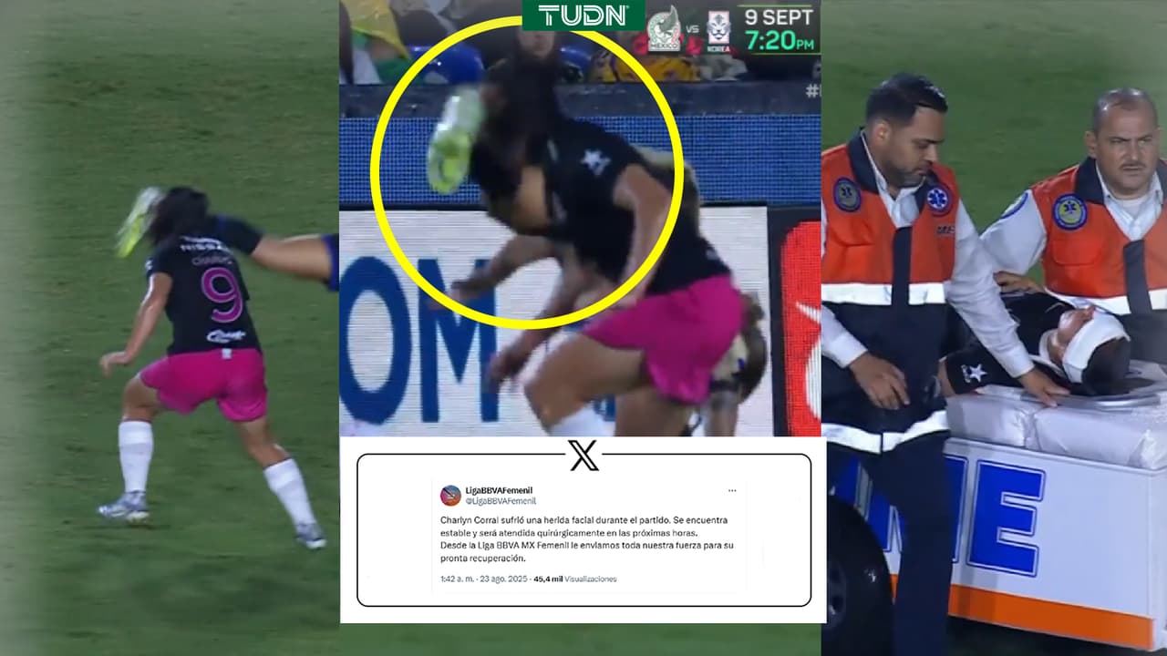 Charlyn Corral requiere de cirugía tras recibir fuerte golpe en su cara
