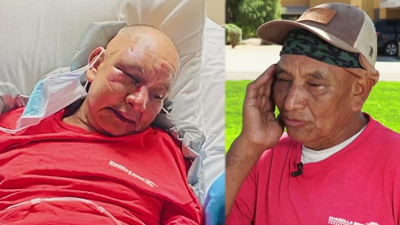 "Me empezó a patear": jardinero hispano da su testimonio tras ser brutalmente golpeado y robado