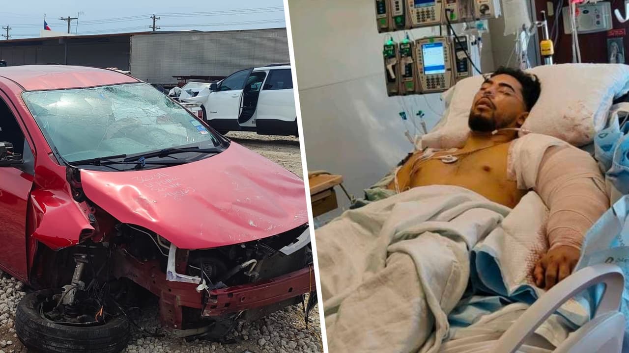 Un joven hispano lucha por no perder su brazo después de que un auto lo chocara y se diera a la fuga en Texas