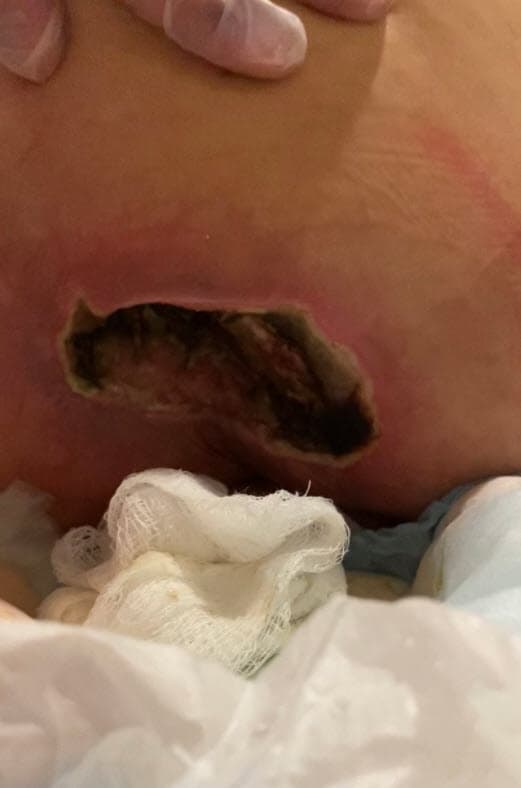 Mostró fotos como esta con la que denunció las heridas que le detectó a quien considera como una madre.
<br>