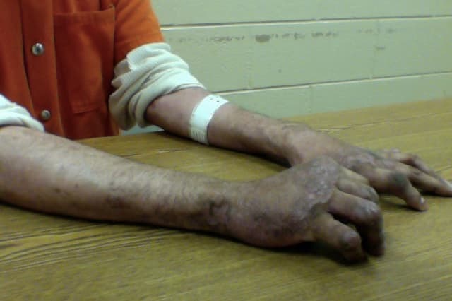 Inmigrante denuncia a ICE por no darle sus medicinas.