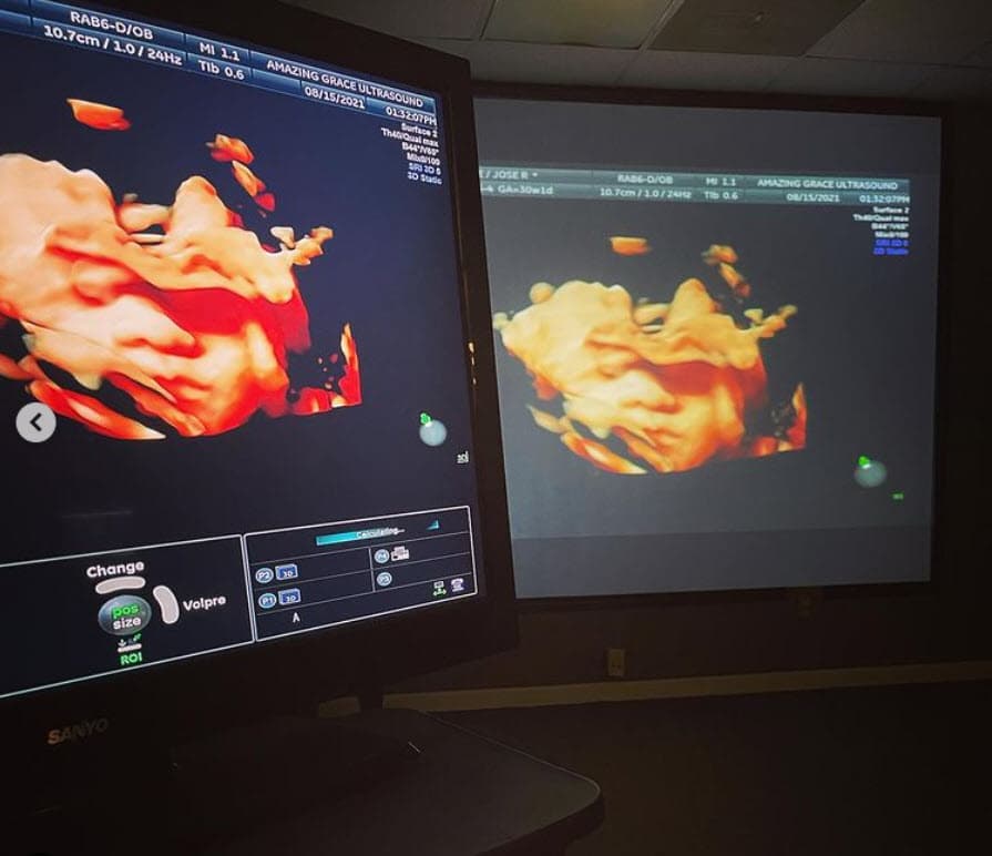 El actor Eduardo Rodríguez ha mostrado apoyo hacia su hijo en esta nueva etapa como padre de familia, sin embargo, también reconoció que quería que el joven terminara su maestría antes de ser papá.
<br>