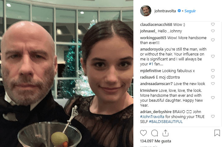 La respuesta de sus seguidores fue favorecedora. La mayoría de ellos coincidieron en señalar que el actor se ve muy bien calvo, incluso hubo quien le comentó se veía más joven y atractivo.