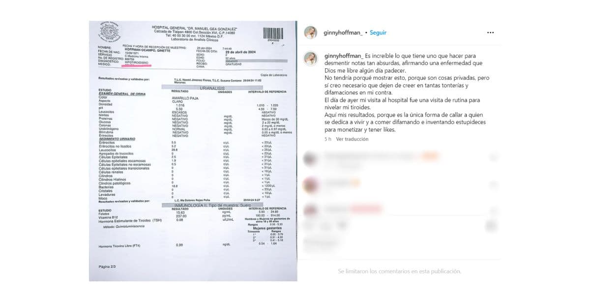 Ginny Hoffman aclara enfermedad: tiene hipotiroidismo