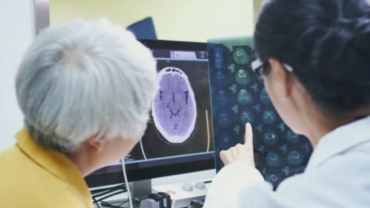 Prueba de sangre ayuda a detectar alzheimer antes de los síntomas, esto dicen los expertos