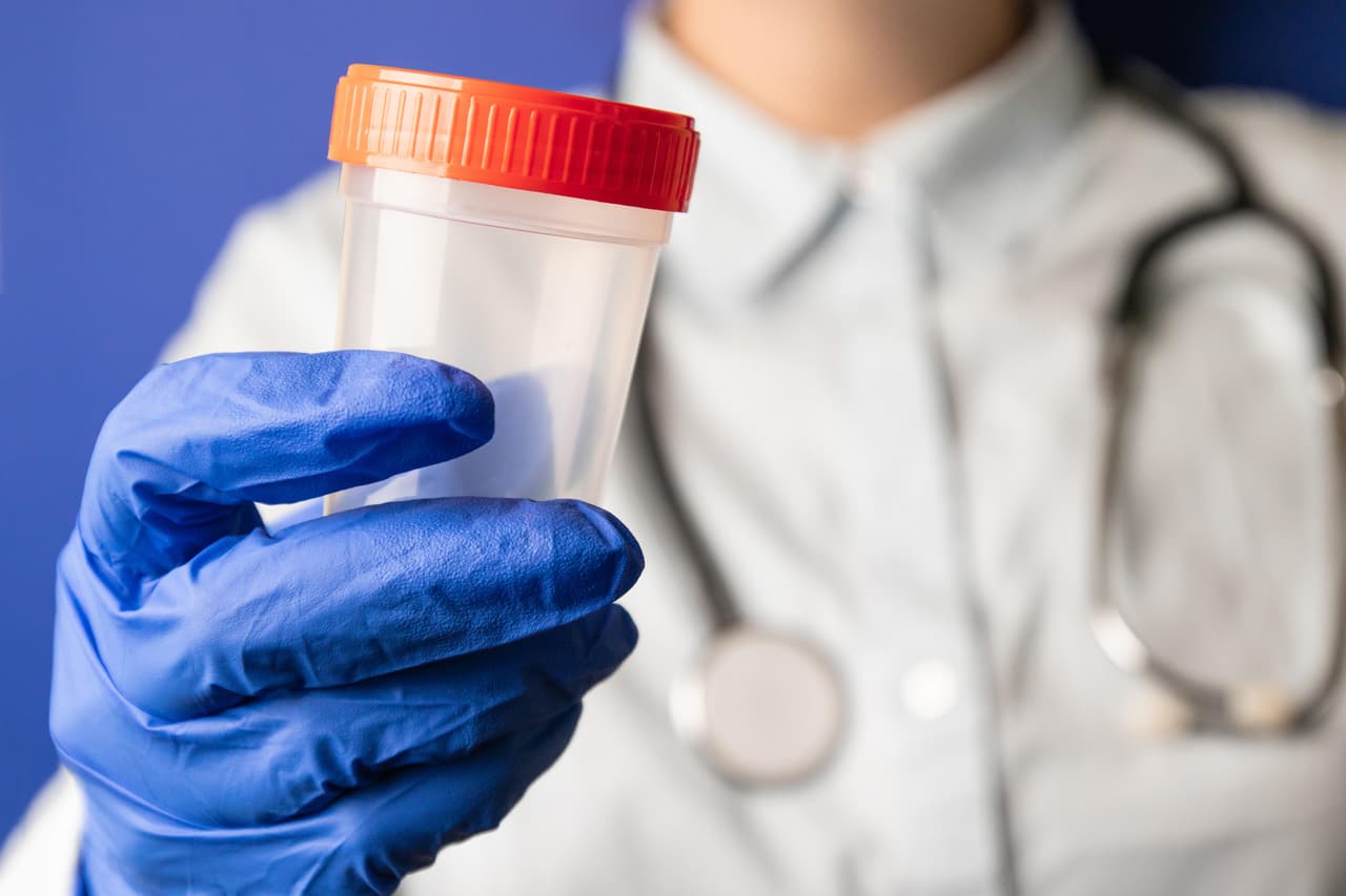 Donación de esperma.