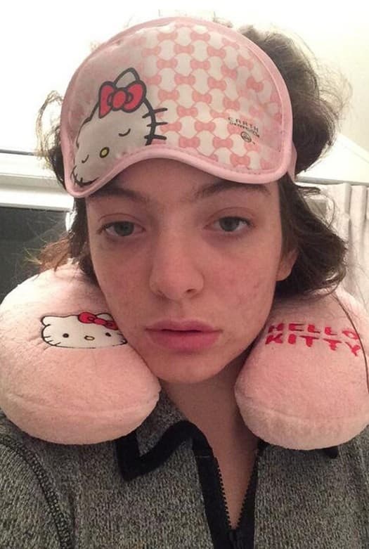 Lorde parece que sobrevivió a la turbulencia. Esta selfie también fue muy desafortunada.