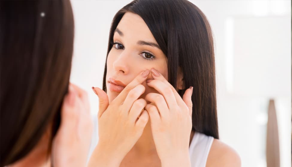 Lo único que tienes que hacer es poner a hervir dos cucharadas de pulpa de mango en una taza de agua, deja enfríar y pasa la mezcla por un colador. El agua restante úsala para lavar tu rostro una vez por día. ¡Verás cambios increíbles!