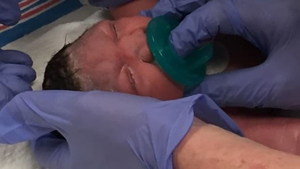 Hondureña en Nueva Jersey quedó devastada al ver cómo el zika afectó a su bebé