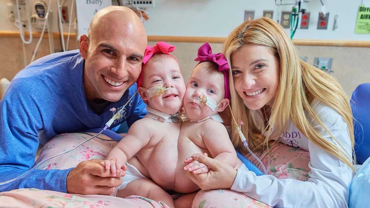 <b>La separación de las siamesas Addy y Lily Altobelli</b>
<br>En enero de 2022, Chicago recibió la buena noticia de la separación de las 
<a href="https://www.univision.com/local/chicago-wgbo/separan-con-exito-a-siamesas-de-chicago" target="_blank">siamesas Addy y Lily Altobelli</a>. 
<br>Las gemelas, hijas de Dom y Maggie Altobelli nacieron unidas por el pecho y luego de varios meses de preparación y de una cirugía de más de 10 horas, fueron separadas con éxito en el Hospital Infantil de Filadelfia.