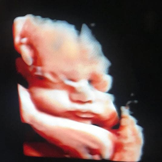 También mostraron el primer ultrasonido de Leonardo en redes sociales.