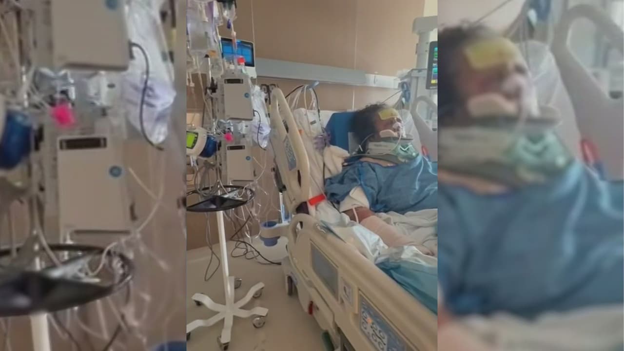 "Está viva de puro milagro": Tres perros atacan gravemente a una mujer y su hija exige justicia