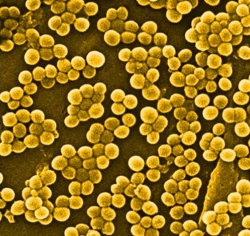 Investigan dos casos de contagio de MRSA en preparatoria en Naperville