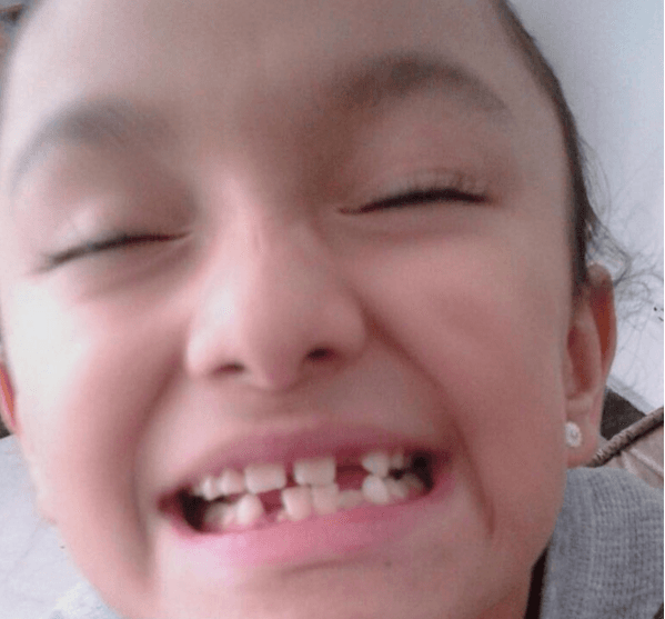 Esta pequeñina también quiso apoyarlo con una gran sonrisa sin dientes.