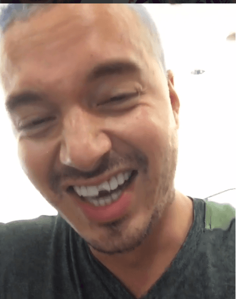 Así se burló J Balvin de su diente roto, aunque eso sí, él afirma que lo guapo no se le quita.