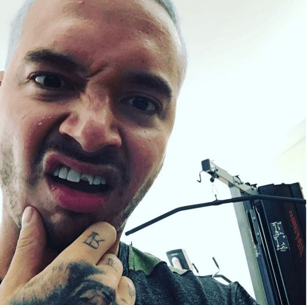 Al pobrecito Parcero se le rompió un diente y como cada momento de su vida, no dudó en compartirlo en sus redes sociales.