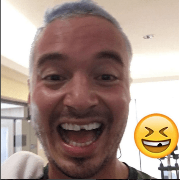 Pero su cuenta social se caracteriza por un gran sentido del humor, como el día que compartió que se rompió su diente frontal.