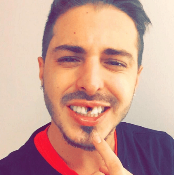 Otro entusiasta que subió su foto con el diente pintado para #ApoyaralParcero.