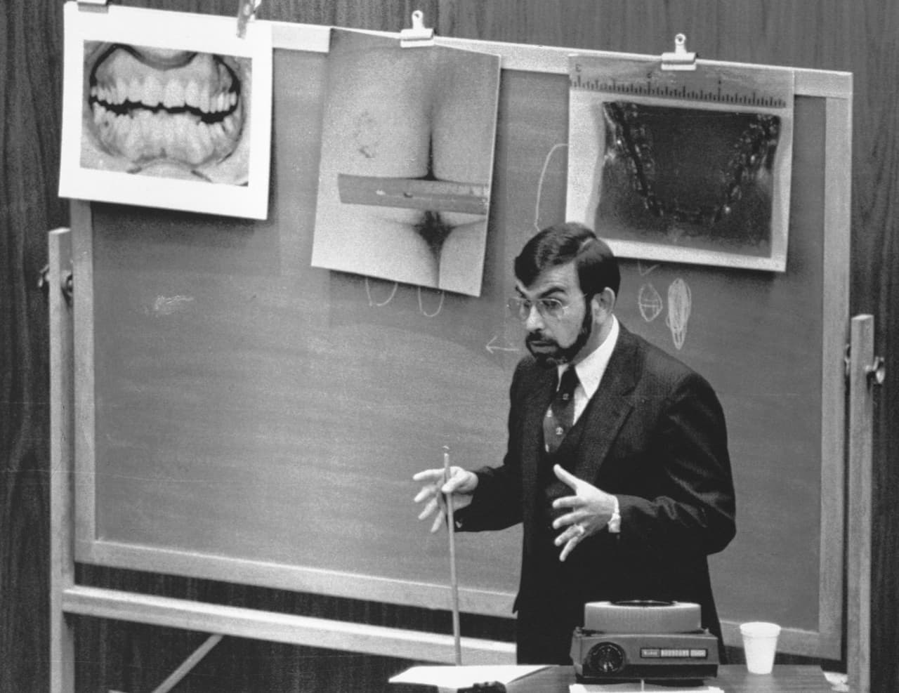 Los odontólogos forenses demostraron que las marcas de mordidas encontradas en los cuerpos de las víctimas pertenecían a Bundy. En la imagen el Dr Lowell J Levine, uno de los expertos en odontología, explica sus hallazgos al jurado.