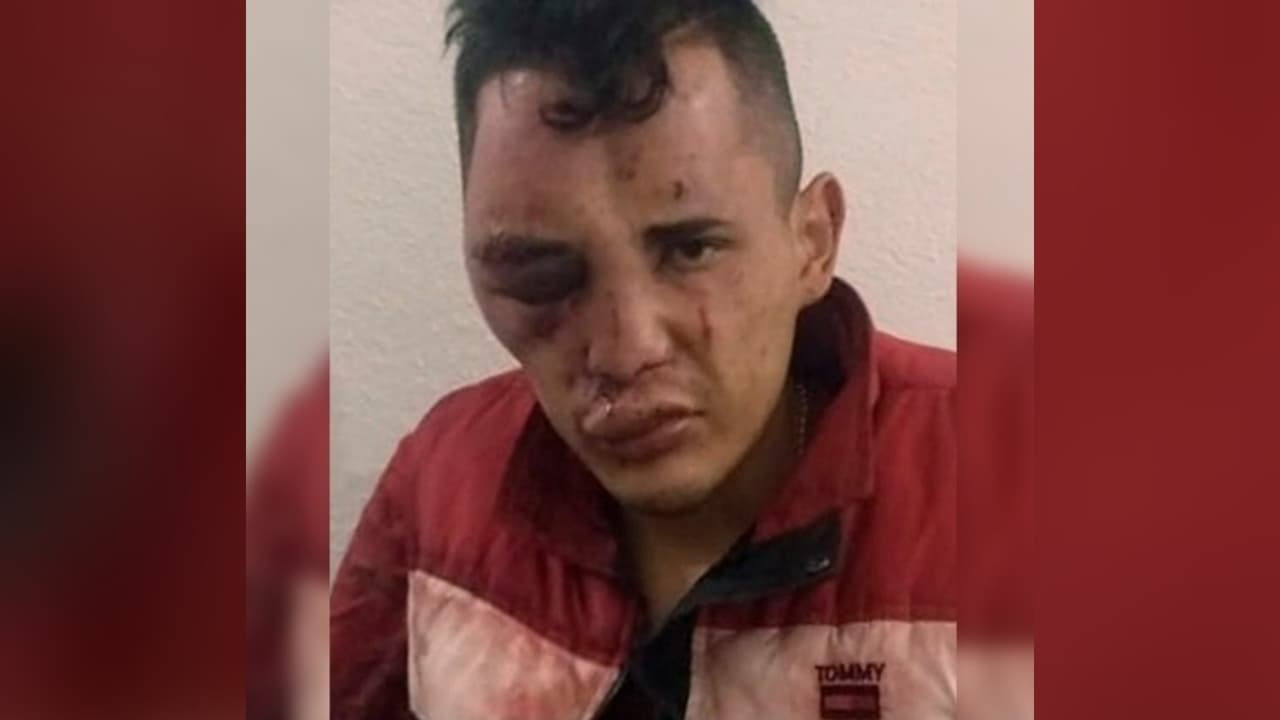 Golpeó a su padre y le prendió fuego: ahora pasará 62 años en prisión por homicidio