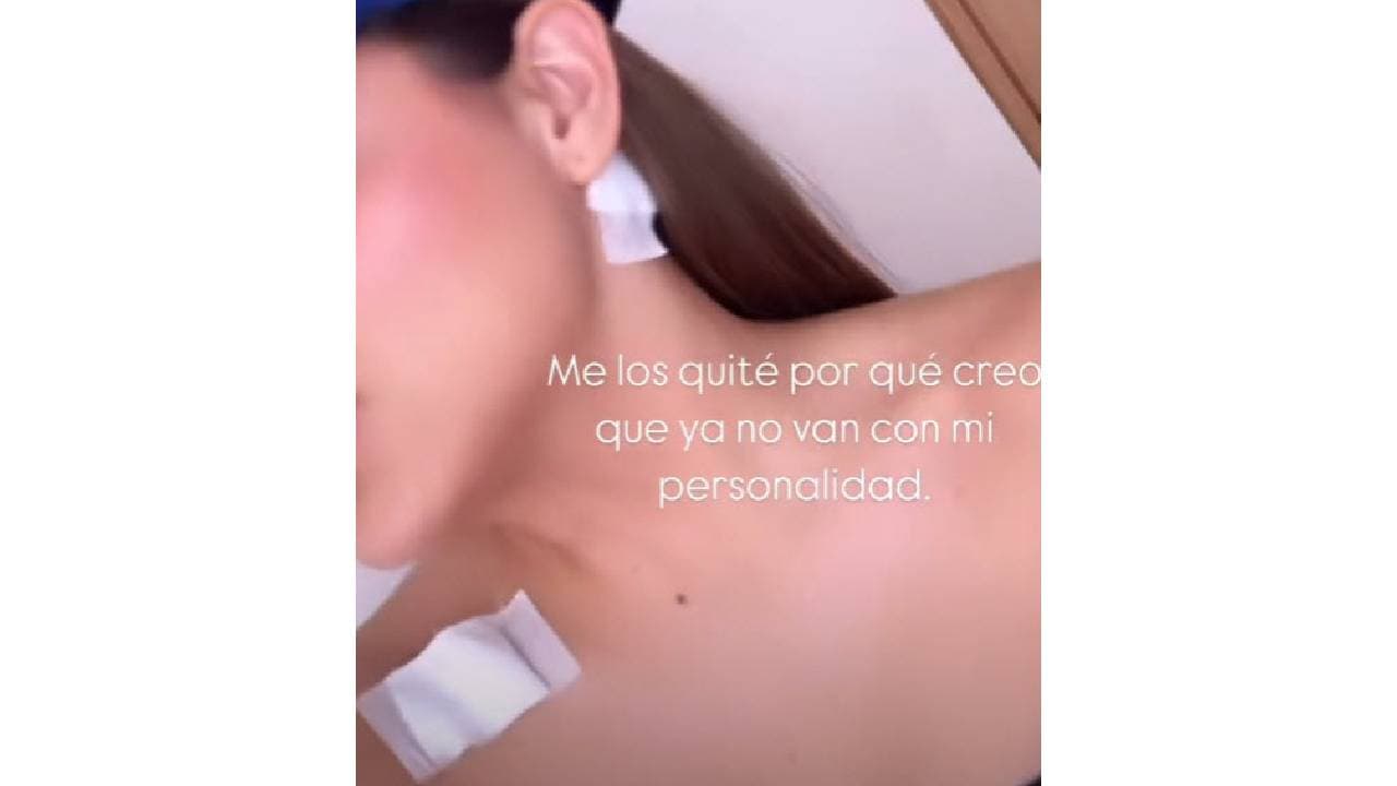 Samadhi Zendejas se sometió a un procedimiento para borrar vrios de sus tatuajes.